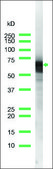 Anti-Keratin 6 antibody, Rabbit monoclonal recombinant, expressed in proprietary host, clone SP87, affinity isolated antibody