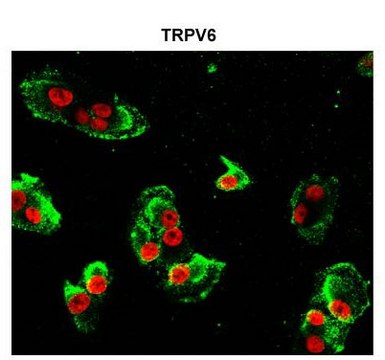 Anti-TRPV6 antibody produced in rabbit affinity isolated antibody