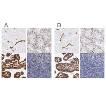 抗-LAMC1 兔抗 Ab1, Prestige Antibodies&#174; Powered by Atlas Antibodies, affinity isolated antibody, buffered aqueous glycerol solution