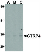 Anti-CTRP4 (ab1) antibody produced in rabbit affinity isolated antibody, buffered aqueous solution
