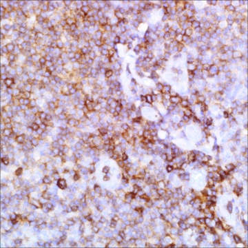 CD43 (SP55) Rabbit Monoclonal Antibody