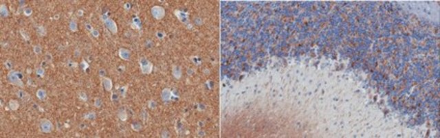 Anti-alpha-Synuclein from rabbit, purified by affinity chromatography