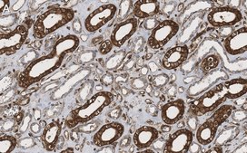 Anti-phospho-TSC2-Ser939 Antibody, clone 1G19 ZooMAb® Rabbit Monoclonal recombinant, expressed in HEK 293 cells