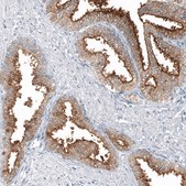Anti-TMPRSS2 antibody produced in mouse Prestige Antibodies® Powered by Atlas Antibodies, clone CL12514, purified by using Protein A, buffered aqueous glycerol solution