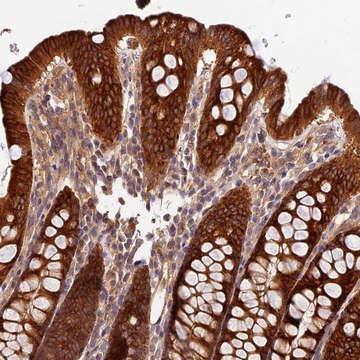 Anti-CES3 antibody produced in rabbit Prestige Antibodies&#174; Powered by Atlas Antibodies, affinity isolated antibody, buffered aqueous glycerol solution