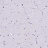 Anti-TBC1D10B antibody produced in rabbit Prestige Antibodies® Powered by Atlas Antibodies, affinity isolated antibody, buffered aqueous glycerol solution