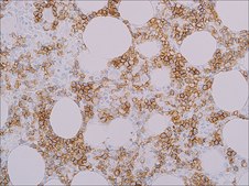 Spectrin (EP251) Rabbit Monoclonal Primary Antibody