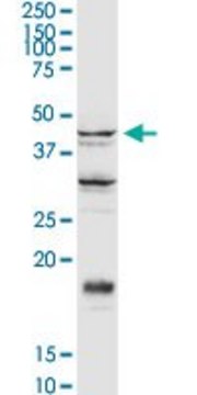 Anti-SGK2 antibody produced in rabbit purified immunoglobulin, buffered aqueous solution