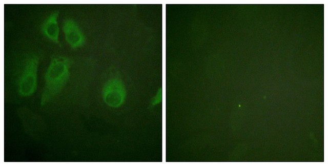 Anti-IL-2R &#945; antibody produced in rabbit affinity isolated antibody