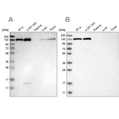 Anti-XPO5 antibody produced in rabbit Prestige Antibodies® Powered by Atlas Antibodies, affinity isolated antibody, buffered aqueous glycerol solution