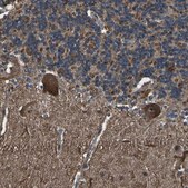 Anti-DHPS antibody produced in rabbit Prestige Antibodies® Powered by Atlas Antibodies, affinity isolated antibody, buffered aqueous glycerol solution