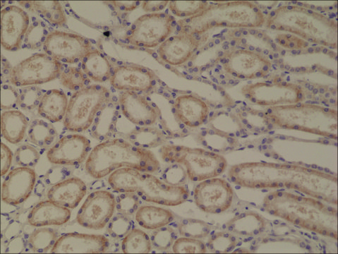 Anti-p120-catenin antibody, Rabbit monoclonal recombinant, expressed in HEK 293 cells, clone RM353, purified immunoglobulin