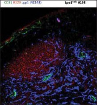 Anti-PPAP2A (AB1) antibody produced in rabbit IgG fraction of antiserum