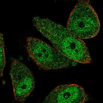 Anti-THSD7B antibody produced in rabbit Prestige Antibodies&#174; Powered by Atlas Antibodies, affinity isolated antibody