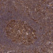 Anti-CAD antibody produced in rabbit Prestige Antibodies® Powered by Atlas Antibodies, affinity isolated antibody