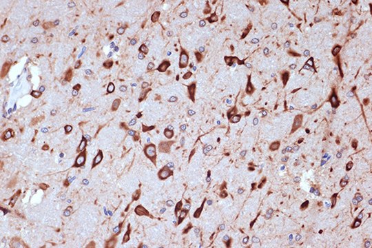 Anti-PRKRA/PACT Antibody, clone 2W2E10, Rabbit Monoclonal