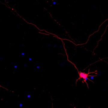 Neuro-Chrom Pan Neuronal Marker Antibody-Rabbit, Cy3 Conjugate Neuro-Chrom, from rabbit