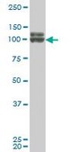 Monoclonal Anti-DDX54, (C-terminal) antibody produced in mouse clone 2E4, purified immunoglobulin, buffered aqueous solution