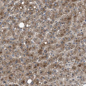 Anti-NEU1 antibody produced in rabbit Prestige Antibodies&#174; Powered by Atlas Antibodies, affinity isolated antibody, buffered aqueous glycerol solution