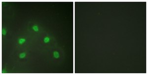 Anti-HNRNP L antibody produced in rabbit affinity isolated antibody