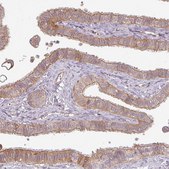 Anti-CNOT1 antibody produced in rabbit Prestige Antibodies® Powered by Atlas Antibodies, affinity isolated antibody, buffered aqueous glycerol solution