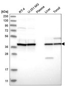 Anti-UROD antibody produced in rabbit Prestige Antibodies® Powered by Atlas Antibodies, affinity isolated antibody