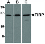 Anti-TIRP (ab2) antibody produced in rabbit affinity isolated antibody, buffered aqueous solution