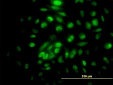 Anti-RPA4 antibody produced in mouse IgG fraction of antiserum, buffered aqueous solution
