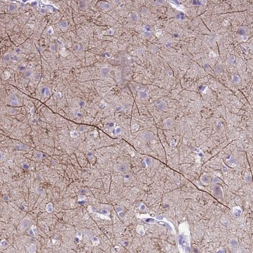 Anti-PIP4K2B antibody produced in rabbit Prestige Antibodies&#174; Powered by Atlas Antibodies, affinity isolated antibody, buffered aqueous glycerol solution