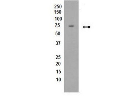 Anti-PP2A Antibody, B subunit, B56 delta, clone H5D12 clone H5D12, Upstate&#174;, from mouse