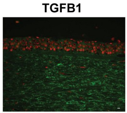 Anti-TGFBI antibody produced in rabbit IgG fraction of antiserum