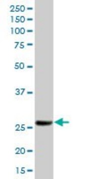 Anti-HPGD antibody produced in mouse purified immunoglobulin, buffered aqueous solution