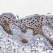 Anti-KLF3 antibody produced in rabbit Prestige Antibodies® Powered by Atlas Antibodies, affinity isolated antibody, buffered aqueous glycerol solution