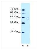 Anti-FAH IgG fraction of antiserum