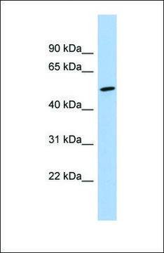 Anti-NKD1 antibody produced in rabbit affinity isolated antibody