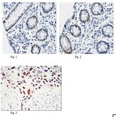 抗-KLF4抗体（克隆1E6） ascites fluid, clone 1E06, from mouse