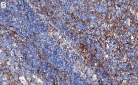 Anti-B7-H3/CD276 Antibody, clone 2E22 ZooMAb® Rabbit Monoclonal recombinant, expressed in HEK 293 cells