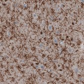 Monoclonal Anti-CNP antibody produced in mouse Prestige Antibodies® Powered by Atlas Antibodies, clone CL2872, purified immunoglobulin, buffered aqueous glycerol solution