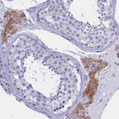 Anti-TMEM97 antibody produced in rabbit Prestige Antibodies® Powered by Atlas Antibodies, affinity isolated antibody, buffered aqueous glycerol solution