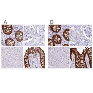 Anti-LGALS4 antibody produced in rabbit Prestige Antibodies® Powered by Atlas Antibodies, affinity isolated antibody, buffered aqueous glycerol solution