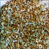 Anti-phospho-CD88/C5aR (pSer338) antibody produced in rabbit affinity isolated antibody