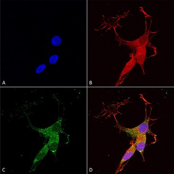 Monoclonal Anti-Copper Transporting Atpase 2 - Fitc antibody produced in mouse clone S62-29, purified immunoglobulin