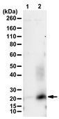 Anti-SNORC purified antibody, from rabbit