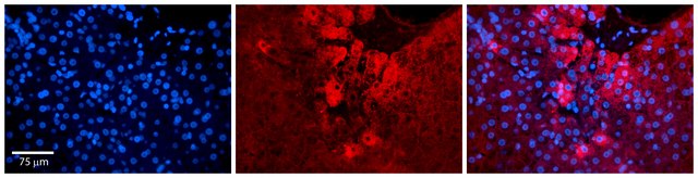 Anti-ZC3H14 antibody produced in rabbit affinity isolated antibody