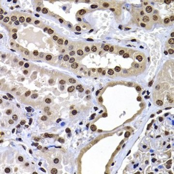 Anti- macroH2A.1 antibody produced in rabbit