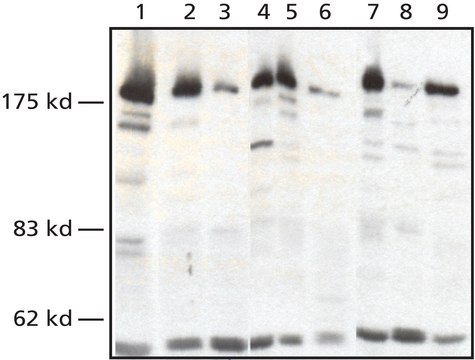 Anti-WSTF (N-Terminal) antibody produced in rabbit affinity isolated antibody, buffered aqueous solution