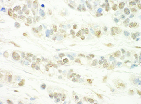 Rabbit anti-WDR5 Antibody, Affinity Purified Powered by Bethyl Laboratories, Inc.