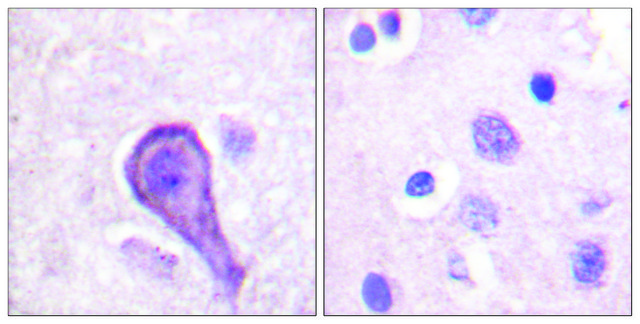 Anti-Rhodopsin antibody produced in rabbit affinity isolated antibody