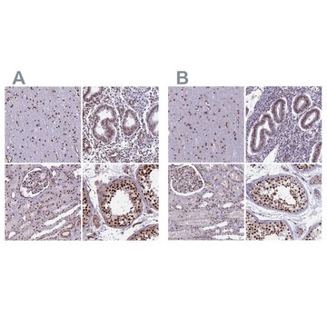 Anti-MPHOSPH8 antibody produced in rabbit Prestige Antibodies&#174; Powered by Atlas Antibodies, affinity isolated antibody, buffered aqueous glycerol solution