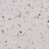 Anti-IFNAR1 antibody produced in rabbit Prestige Antibodies® Powered by Atlas Antibodies, affinity isolated antibody, buffered aqueous glycerol solution